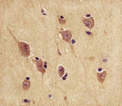 IHC analysis of FFPE human brain tissue stained with the PGP9.5 antibody