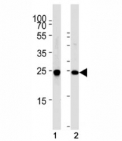 Western blot analysis of lysate from (1) SH-SY5Y cell line and (2) mouse brain tissue using PGP 9.5 antibody at 1:1000. Predicted molecular weight ~25 kDa.