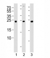Western blot analysis of lysate from 1) 293, 2) SW620, and 3) U-87 MG cell line using UCHL3 antibody at 1:1000. Predicted molecular weight ~26 kDa.