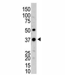 Western blot testing of UCH37 antibody and mouse kidney tissue lysate~