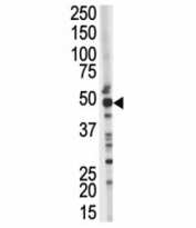 Western blot testing of TSG101 antibody and mouse kidney tissue lysate. Predicted molecular weight ~45 kDa.