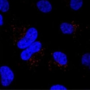 Immunofluorescent staining of HeLa cells incubated with Mib1 antibody at a dilution of 1:20.