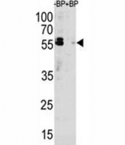 Western blot analysis of p62 antibody pre-incubated without (Lane 1) and with (2) blocking peptide in MCF-7 lysate