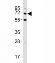 Western blot testing of p62 antibody at 1:500 dilution + HeLa lysate; Predicted band size : 47~62 kDa.