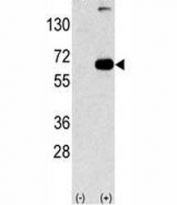 Western blot analysis of p6 antibody and 293 cell lysate (2 ug/lane) either nontransfected (Lane 1) or transiently transfected with the SQSTM1/p62 gene (2).