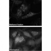 Immunofluorescence staining of p62 antibody on Methanol-fixed and PFA fixed HeLa cells. Data courtesy of Dr. Eeva-Liisa Eskelinen, University of Helsinki, Finland.