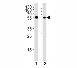 Chk1 antibody western blot analysis in (1) HeLa cell line and (2) mouse thymus tissue lysate