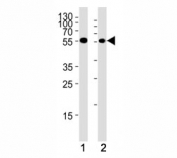 Chk1 antibody western blot analysis in (1) HeLa cell line and (2) mouse thymus tissue lysate. Predicted molecular weight ~54kDa.