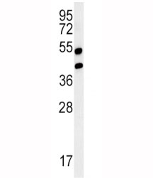 Western blot analysis of AGER / RAGE in mouse lung tissue lysate. Predicted molecular weight: 45-55 kDa.~