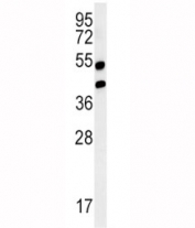 Western blot analysis of AGER / RAGE in mouse lung tissue lysate. Predicted molecular weight: 45-55kDa depending on glycosylation level.