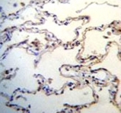 RAGE antibody immunohistochemistry analysis in formalin fixed and paraffin embedded human lung tissue.