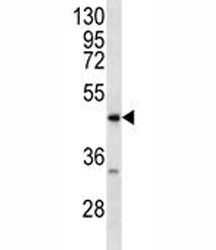 RAGE antibody western blot analysis in MDA-MB231 lysate. Predicted molecular weight: 45-55 kDa.~