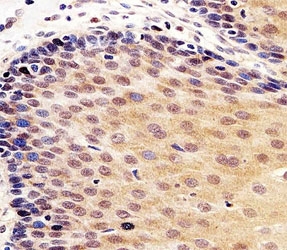 IHC analysis of FFPE human esophagus section using anti-p53 antibody; Ab was diluted at 1:100.~