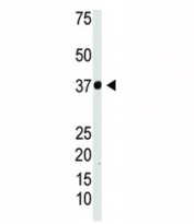 IKBa antibody used in western blot to detect IKB-alpha in Jurkat cell lysate