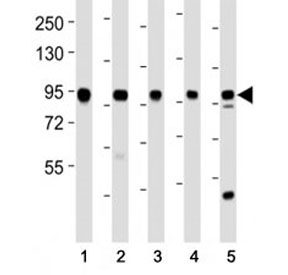 Western blot testing of EZH2 antibody at 1:2000 dilution. Lane 1: Jurkat lysate; 2: MDA-MB-231 lysate; 3: MDA-MB-468 lysate; 4: T47D lysate; 5: mouse spleen lysate; Predicted size: 85-95 kDa