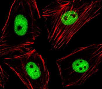 Confocal immunofluorescent analysis of EZH2 antibody and human HeLa cells followed by Alexa Fluor 488-conjugated goat anti-rabbit lgG (green). Actin filaments have been labeled with Alexa Fluor 555 phalloidin (red).