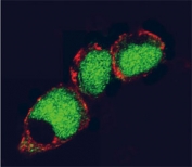 Confocal immunofluorescent analysis of EZH2 antibody and human HEK293 cells followed by Alexa Fluor 488-conjugated goat anti-rabbit lgG (green). Actin filaments have been labeled with Alexa Fluor 555 phalloidin (red).