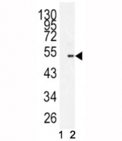 Western blot analysis of BMI1 antibody and 293 lysate in the presence (1) and absence (2) of immunizing peptide.