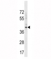 BMI1 antibody western blot analysis in K562 lysate. Predicted molecular weight: 37-43 kDa.