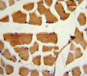 IHC analysis of FFPE human skeletal muscle stained with BMI1 antibody