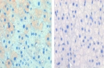 IHC data of FFPE cow lactation tissue tested with CPT1A antibody (left) and without primary Ab (right). This data was kindly offered by Hideaki Hayashi, University of Bern, Switzerland.