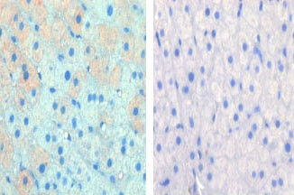 IHC data of FFPE cow lactation tissue tested with CPT1A antibody (left) and without primary Ab (right). This data was kindly offered by Hideaki Hayashi, University of Bern, Switze