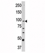 Western blot analysis of CPT1A antibody and Y79 lysate. Predicted molecular weight ~86kDa.