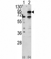 Western blot analysis of CPT1B antibody and 293 cell lysate either nontransfected (Lane 1) or transiently transfected with the CPT1B gene (2).