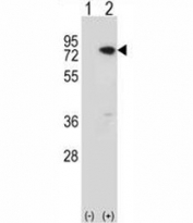 Western blot analysis of MeCP2 antibody and 293 cell lysate (2 ug/lane) either nontransfected (Lane 1) or transiently transfected (2) with the MeCP2 gene. Observed molecular weight: ~55 kDa and ~75 kDa.