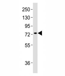Western blot testing of MeCP2 antibody at 1:2000 dilution + mouse brain lysate; Observed molecular weight: ~55 kDa and ~75 kDa.~