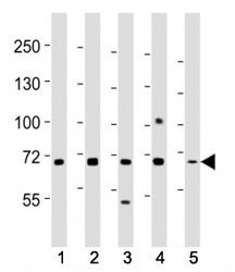Western blot testing of MeCP2 antibody at 1:2000 dilution. Lane 1: SH-SY5Y lysate; 2: Jurkat; 3: A431; 4: