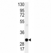 Western blot analysis of Cyclin D1 antibody and mouse lung lysate. Predicted molecular weight: 32-36 kDa.