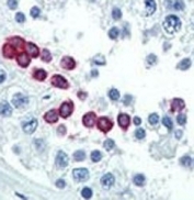 IHC analysis of FFPE human testis tissue stained with Cyclin D1 antibody