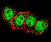 Confocal immunofluorescent analysis of Cyclin D1 antibody with HeLa cells followed by Alexa Fluor 488-conjugated goat anti-rabbit lgG (green). Actin filaments have been labeled with Alexa Fluor 555 Phalloidin (red).