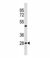 Prohibitin antibody western blot analysis in HepG2 lysate. Predicted molecular weight ~29 kDa.