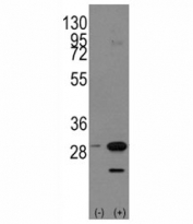 Western blot analysis of PHB antibody and 293 cell lysate either nontransfected (Lane 1) or transiently transfected with the PHB1 gene (2). Predicted molecular weight ~29 kDa.