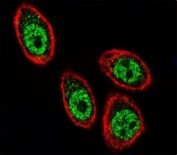 Confocal immunofluorescent analysis of PHB antibody with HeLa cells followed by Alexa Fluor 488-conjugated goat anti-rabbit lgG (green). Actin filaments have been labeled with Alexa Fluor 555 Phalloidin (red).