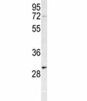 Western blot testing of PHB antibody and HeLa cell lysate. Predicted molecular weight ~28 kDa.