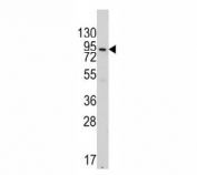Western blot analysis of VE Cadherin antibody and 293 lysate. Expected molecular weight: 90~140 kDa depending on glycosylation level