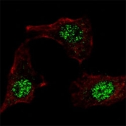 IF staining of HeLa cells with KLF4 antibody at 1:100, response is localized to the nuclei.