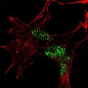Fluorescent confocal image of SY5Y cells stained with KLF4 antibody at 1:100. KLF4 immunoreactivity is localized to the nuclei.
