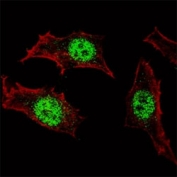 Fluorescent confocal image of HeLa cells stained with KLF4 antibody at 1:100. Immunoreactivity is localized specifically to the nuclei.