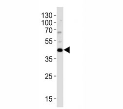 Western blot analysis of lysate from HT29 cell line using KLF4 antibody; Ab was diluted at 1:1000. Predicted molecular weight: 50-60 kDa + ~75 kDa