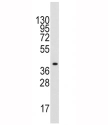 Western blot analysis of ALDOA antibody and mouse liver tissue lysate. Predicted molecular weight ~40 kDa.