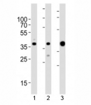 Western blot analysis of lysate from 1) MCF-7, 2) HeLa cell line and 3) human skeletal muscle tissue lysate using ALDOA antibody at 1:1000. Predicted molecular weight ~40 kDa.