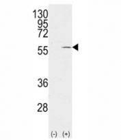 Western blot analysis of Vimentin antibody and 293 cell lysate (2 ug/lane) either nontransfected (Lane 1) or transiently transfected with the VIM gene (2).