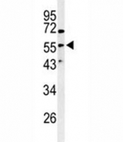 Western blot analysis of Vimentinin antibody and HeLa lysate