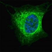 Fluorescent confocal image of SY5Y cells stained with Vimentin antibody at 1:200. The immunosignal is localized to the cytoskeleton.