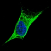 Fluorescent confocal image of SY5Y cells stained with anti-Vimentin antibody at 1:100. Vimentin is localized to the cytoskeleton.