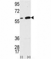 Western blot analysis of VIM antibody and 293 cell lysate (2 ug/lane) either nontransfected (Lane 1) or transiently transfected with the VIM gene (2).